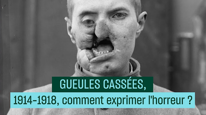 11 novembre : comment exprimer l'horreur ? Gueules Cassées 1914-1918  - Culture Prime