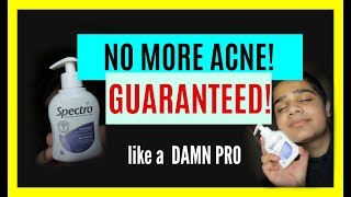 My Miracle- NO MORE ACNE OR BLEMISHES