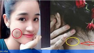 Vận mệnh người có má lúm đồng tiền, nốt ruồi trước ngực hoặc sau gáy