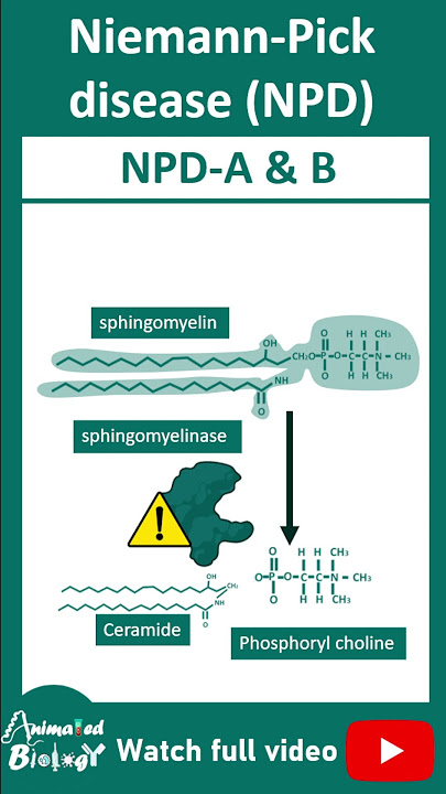 High Yielding Shorts-111 (#HYS-111):Niemann-Pick Disease Dr Devesh