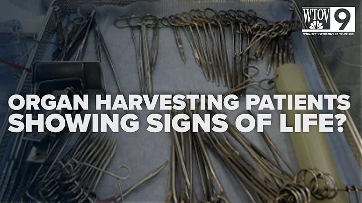 'Unethical': HHS report reveals organ harvesting while patients still show signs of life