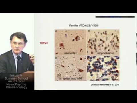 Video: Neuroimaging Longitudinale E Profili Neuropsicologici Della Demenza Frontotemporale Con Espansioni C9ORF72