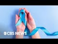 Colorectal cancer becomes biggest cause of cancer-related death for young Americans, study finds