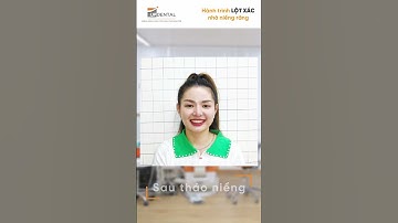 Hành trình LỘT XÁC nhờ niềng răng của khách hàng Ngọc Giang