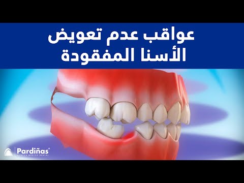 فيديو: 5 عواقب مخيفة لإهمال أسنان كلبك
