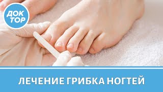 Популярные ошибки в лечении грибка ногтей