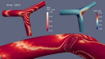 [Ca2+] Dynamics in Smooth Muscle Cells—110° Arterial Bifurcation Simulation
