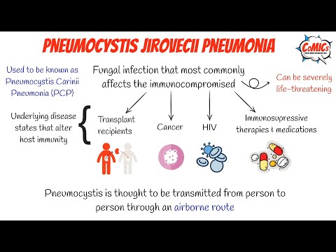 CoMICs Episode 51: Pneumocystis Jiroveci Pneumonia