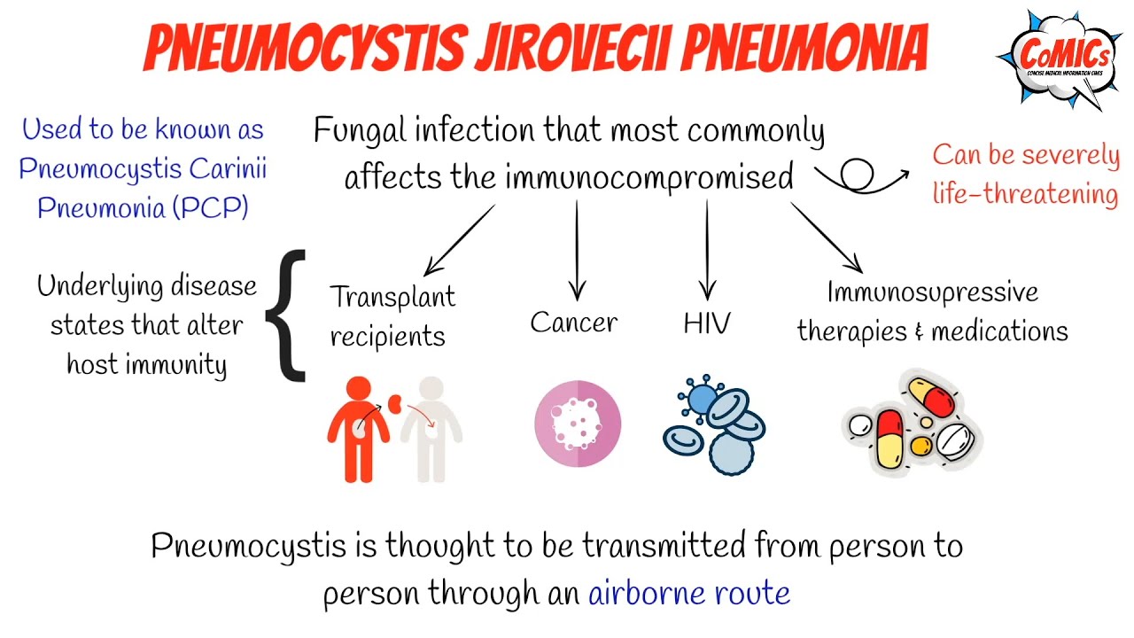 CoMICs Episode 51: Pneumocystis Jiroveci Pneumonia