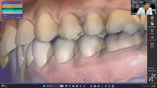 Detalles Free Dental workflow Noticias