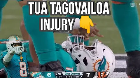 Tua Tagovailoa Stretchered Off After SEVERE Head Injury - Doctor Explains | scary injury Bengals