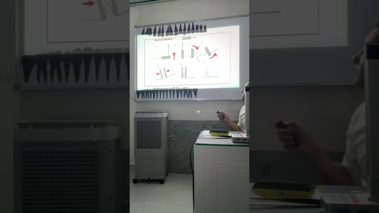 Cách bẻ Geaw điều trị hạng 3 High Angle