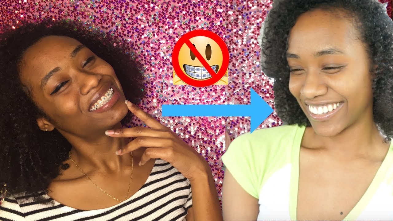 BRACE FACE NO MORE | OLIVIA DOLLI