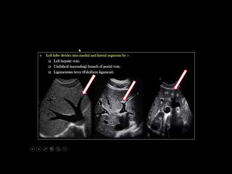 Como Liver Ultrasound -Dr. Ismail Sayed Ismail -parte 2