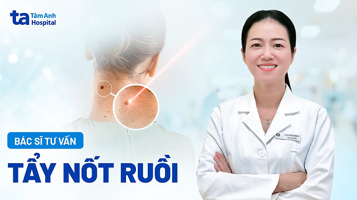 Tẩy nốt ruồi bệnh viện da liễu bao nhiêu tiền