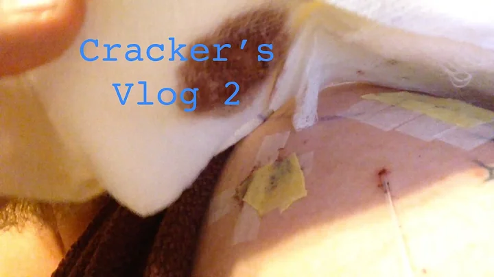 Joe Cracker's Vlog 2 - Victor McGee after shoulder...