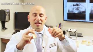 Implants if I have a top denture? | Daniel Daniel Dentistry