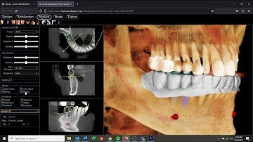 Invivo Workspace Prime Viewer를 소개합니다.
