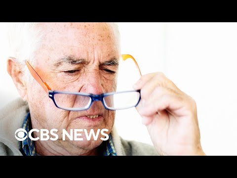 Vision changes could be early indicator of dementia, study finds.