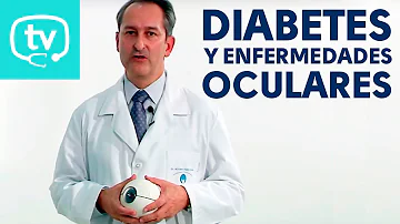 ¿Por qué los diabéticos necesitan revisiones oculares periódicas?