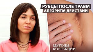 Рубцы после травм: как избежать осложнений и улучшить внешний вид