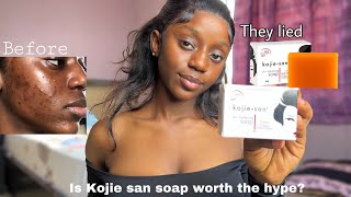 DID THEY LIE ABOUT KOJIE SAN SOAP| HONEST REVIEW