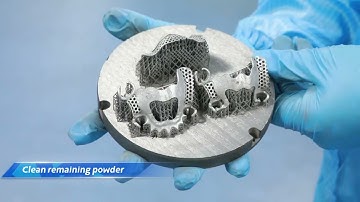 Complete digital 3D printing process of partial frameworks from Chamlion M150