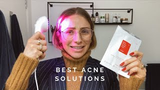 HOW TO GET RID OF ACNE | Pregnancy Skincare and LightStim Review | Jillian Lansky