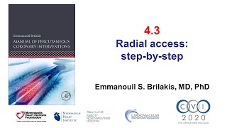4.3 Radial artery access: step-by-step - Manual of PCI