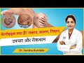 Keloids का क्या इलाज है ? Keloid Removal Treatment | Keloid का इलाज |