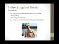 Hernias || Boards and Beyond || Gastroenterology