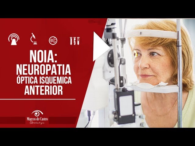 Como a blefarite afeta os olhos – Donato Hospital de Olhos