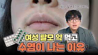 여성형 탈모 치료방법과 미녹시딜 먹는 약 복용 시 주의사항