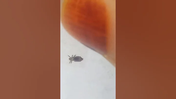 Prevention Is Better Than Cure #shorts #yt #ytviral