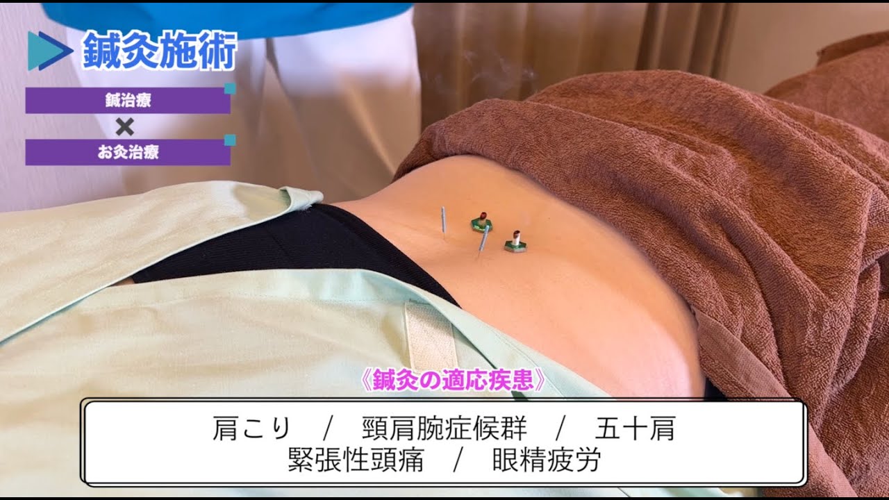 鍼灸施術 YouTube