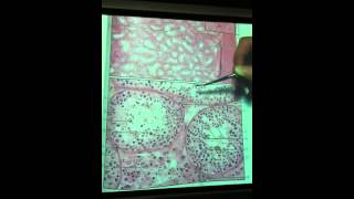 Testes slide