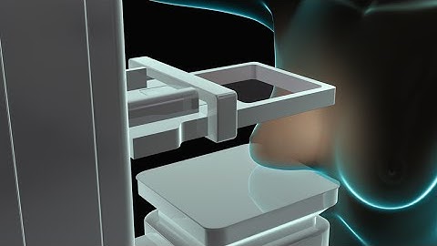 Breast Cancer | Mammogram