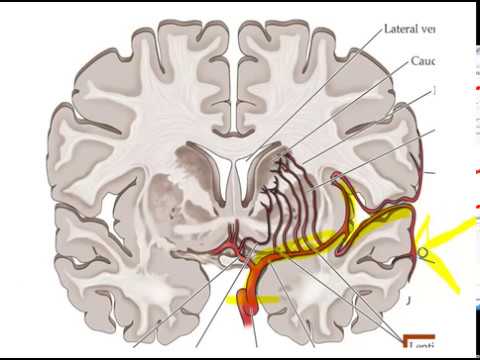 MIDDLE CEREBRAL ARTERY BRANCHES (MCA) -PART 1