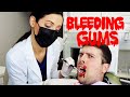 Bleeding Gums Are NOT Normal! What You Need To Know