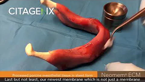 Comparison Resorbable Dental Collagen Membrane & Extracellular Matrix | Citagenix