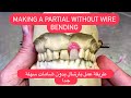 Making a partial denture without clasps (flipper) طريقة عمل بارشال بدون ضامات سهلة جداً