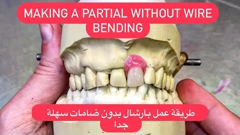 Making a partial denture without clasps (flipper) طريقة عمل بارشال بدون ضامات سهلة جداً #WAXBAE