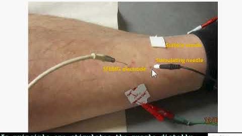 SFEMG - Direct Muscle Stim  (Erik Stalberg)