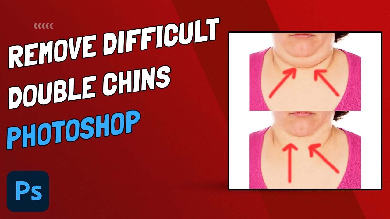 How To Remove (Difficult) Double Chin CC YouTube