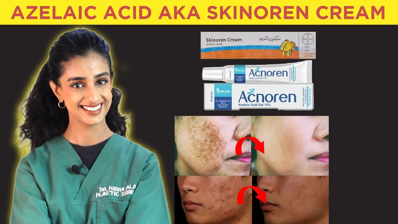 All about Azelaic acid - Skinoren cream review - Dr. Hirra Alavi