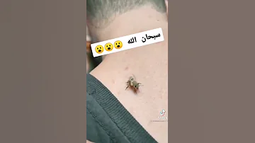 لي مزال ماشفش طريقة كويان أو علاج طبيعي بالنحل علي أمراض يدخل 