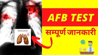 Acid Fast Bacilli Test Procedure | AFB Test for TB in Hindi