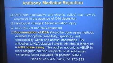 Solid phase anti-HLA antibody testing in kidney transplantation
