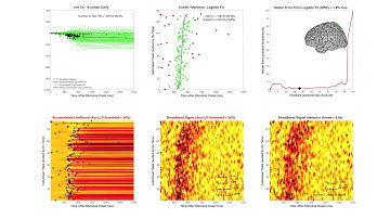 ECoG Onset Detection based on Likelihood Estimates and Minimum Error