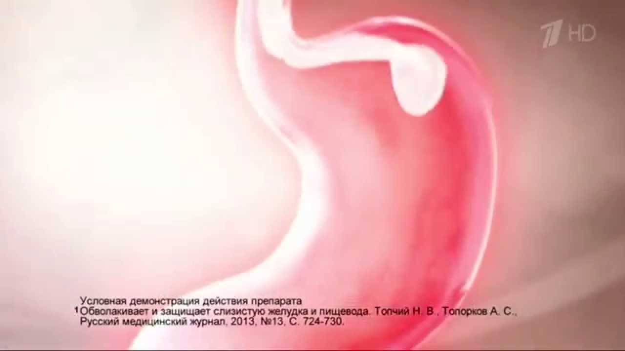 Реклама Гастал - Три действия